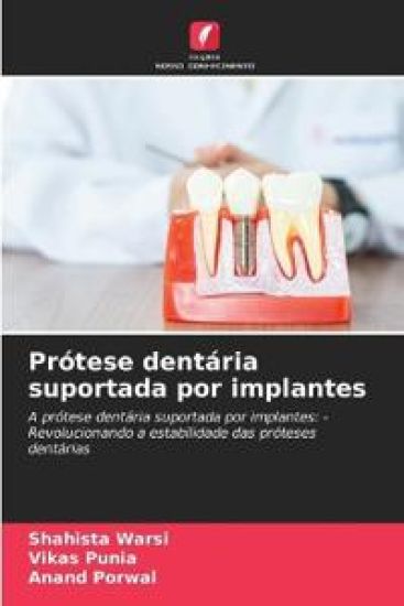Prótese dentária suportada por implantes