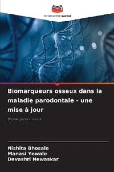 Biomarqueurs osseux dans la maladie parodontale - une mise à jour