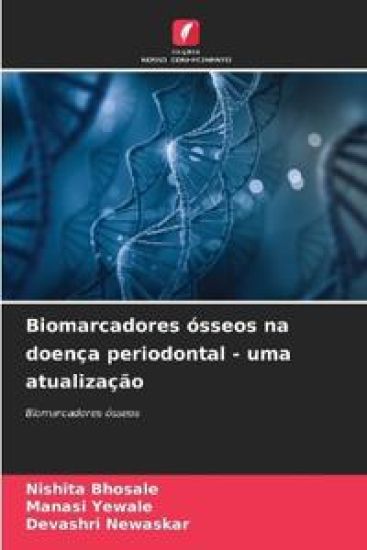 Biomarcadores ósseos na doença periodontal - uma atualização