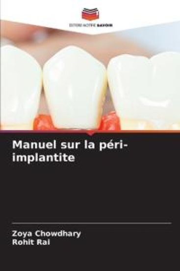 Manuel sur la péri-implantite