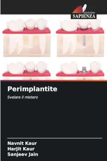 Perimplantite