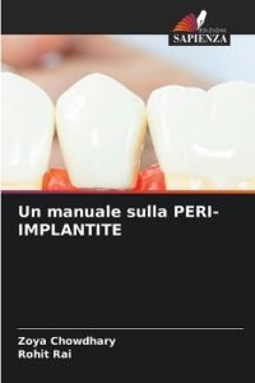 Un manuale sulla PERI-IMPLANTITE