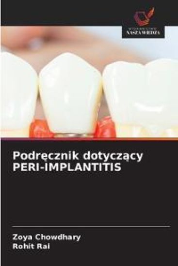 Podrecznik dotyczacy PERI-IMPLANTITIS