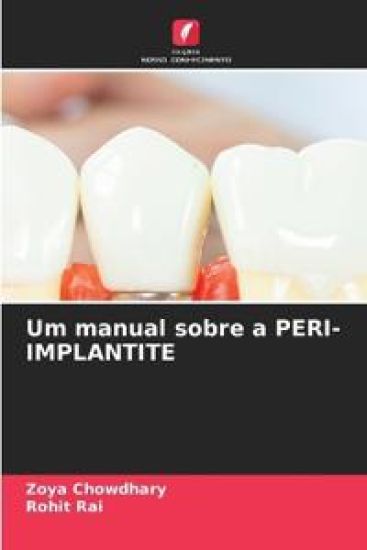 Um manual sobre a PERI-IMPLANTITE