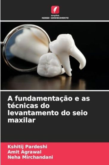 A fundamentação e as técnicas do levantamento do seio maxilar