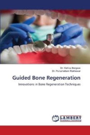 Guided Bone Regeneration