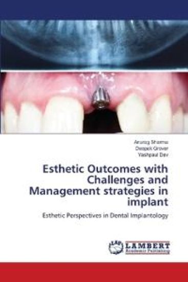 Esthetic Outcomes with Challenges and Management strategies in implant