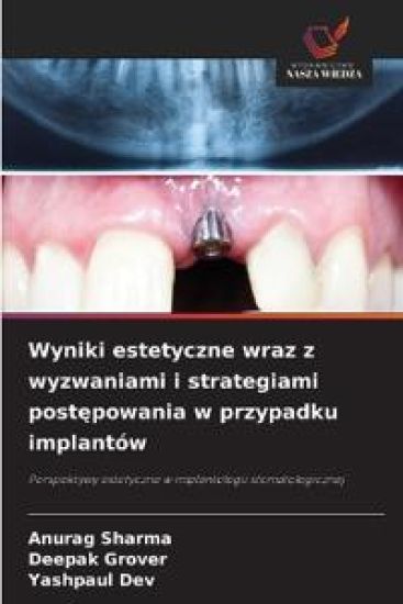 Wyniki estetyczne wraz z wyzwaniami i strategiami postepowania w przypadku implantów