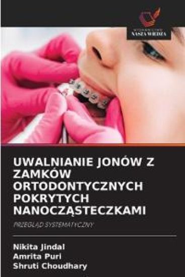 Uwalnianie Jonów Z Zamków Ortodontycznych Pokrytych NanoczAsteczkami