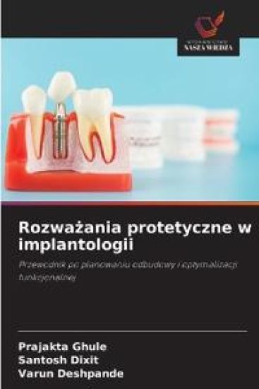 Rozważania protetyczne w implantologii
