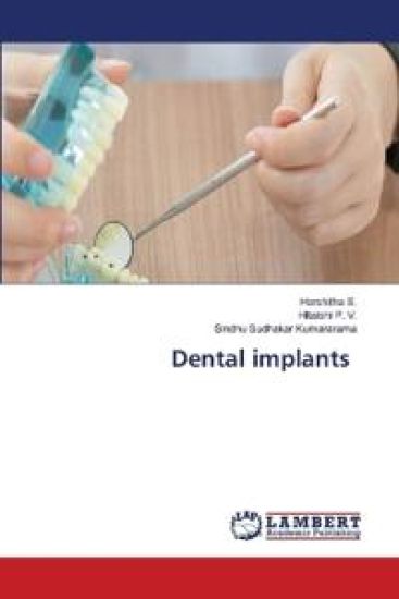 Dental implants