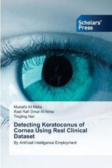 Detecting Keratoconus of Cornea Using Real Clinical Dataset
