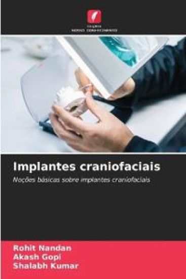 Implantes craniofaciais