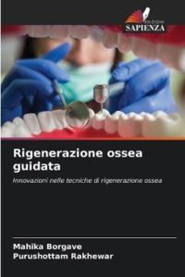 Rigenerazione ossea guidata