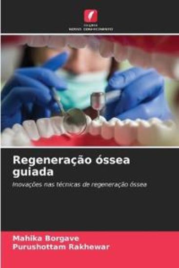 Regeneração óssea guiada