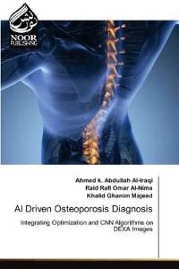 AI Driven Osteoporosis Diagnosis