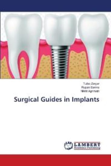 Surgical Guides in Implants