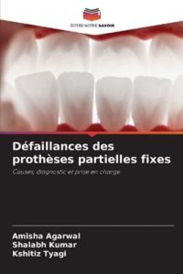 Défaillances des prothèses partielles fixes