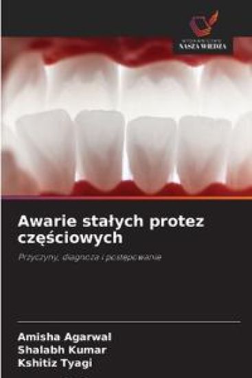 Awarie stalych protez częściowych