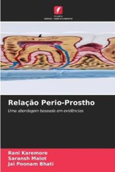 Relação Perio-Prostho