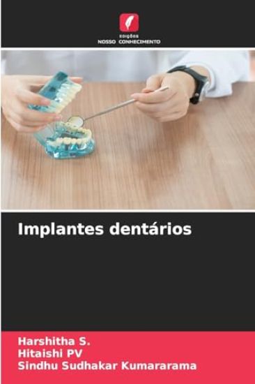 Implantes dentários