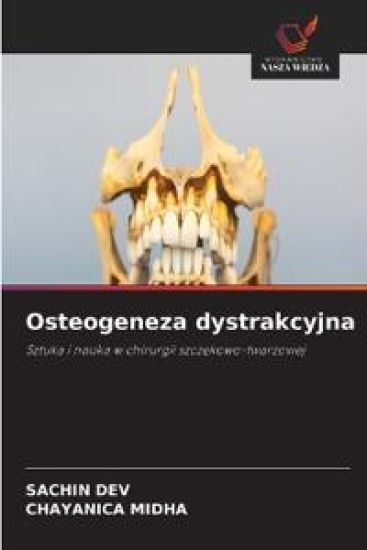 Osteogeneza dystrakcyjna