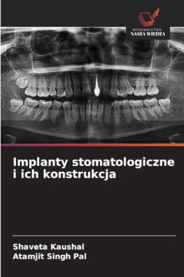 Implanty stomatologiczne i ich konstrukcja