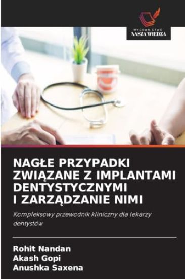 NAG¿E PRZYPADKI ZWI¿ZANE Z IMPLANTAMI DENTYSTYCZNYMI I ZARZ¿DZANIE NIMI