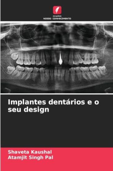 Implantes dentários e o seu design