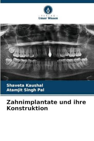 Zahnimplantate und ihre Konstruktion