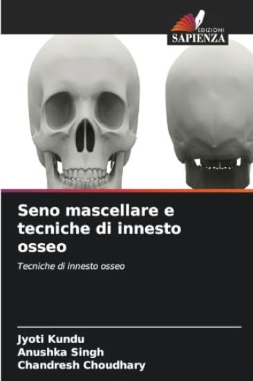 Seno mascellare e tecniche di innesto osseo