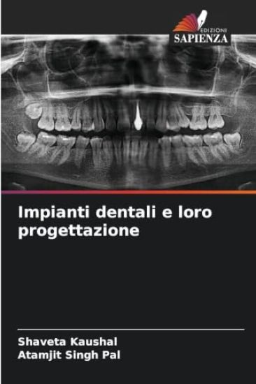 Impianti dentali e loro progettazione