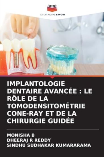 Implantologie Dentaire Avancée – Monisha B, kirjan kansikuva