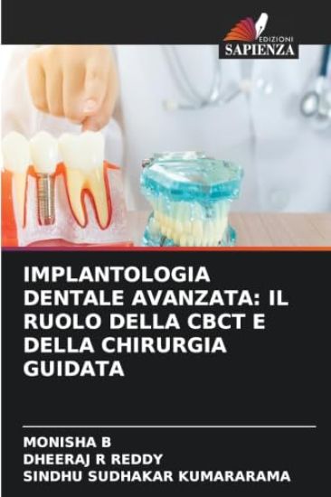 Implantologia Dentale Avanzata