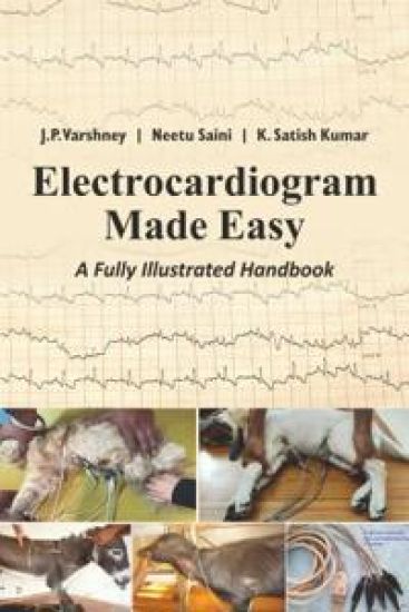 Electrocardiogram Made Easy
