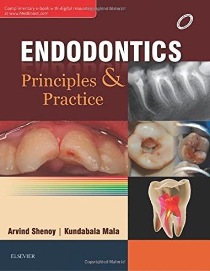 Endodontics: Principles and Practice