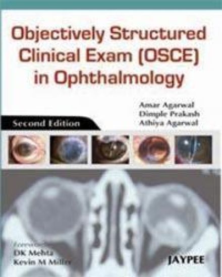 Objectively Structured Clinical Exam (OSCE) in Ophthalmology