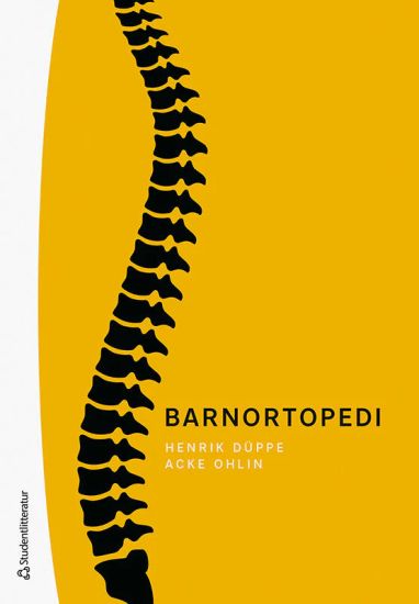 Barnortopedi
