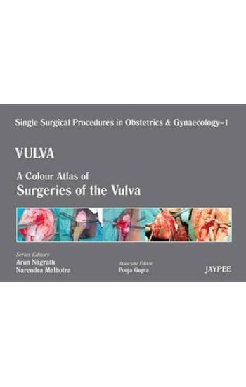 Single Surgical Procedures in Obstetrics and Gynaecology - Volume 1 - VULVA