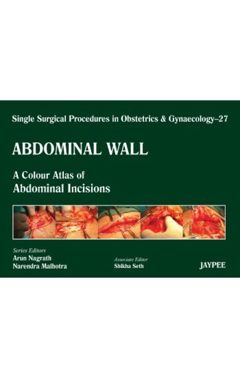 Single Surgical Procedures in Obstetrics and Gynaecology - Volume 27 - Abdominal Wall