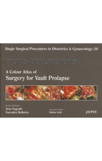 Single Surgical Procedures in Obstetrics and Gynaecology - Volume 20 - UTERUS - DISPLACEMENTS
