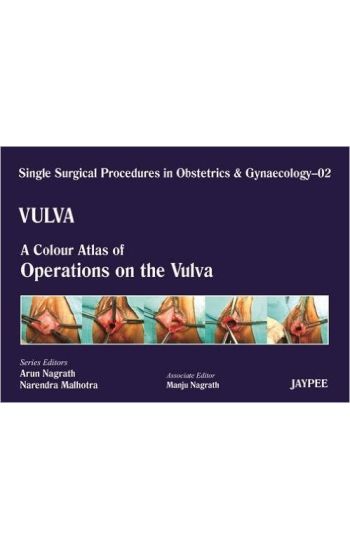 Single Surgical Procedures in Obstetrics and Gynaecology - Volume 2 - VULVA - A Colour Atlas of Operations on the Vulva