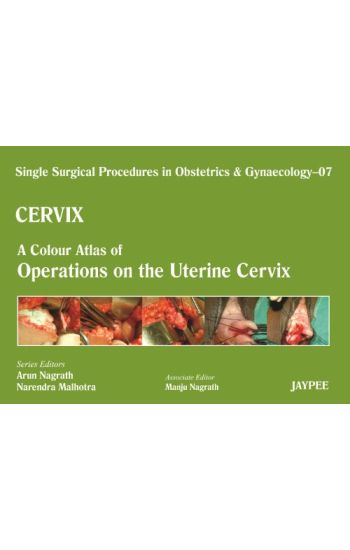 Single Surgical Procedures in Obstetrics and Gynaecology - Volume 7 - CERVIX - A Colour Atlas of Operations on the Uterine Cervix