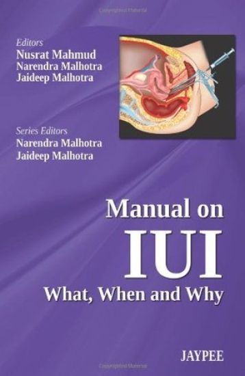 Manual on IUI: What, When and Why