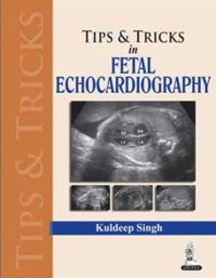 Tips & Tricks in Fetal Echocardiography