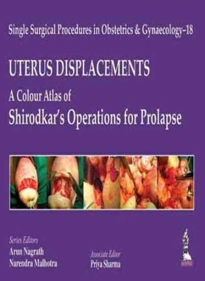 Single Surgical Procedures in Obstetrics and Gynaecology - 18: UTERUS DISPLACEMENTS: A Colour Atlas of Shirodkar's Operations for Prolapse