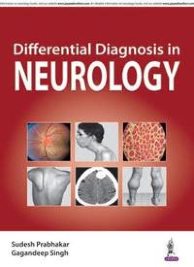Differential Diagnosis in Neurology