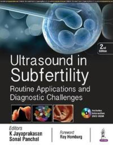 Ultrasound in Subfertility