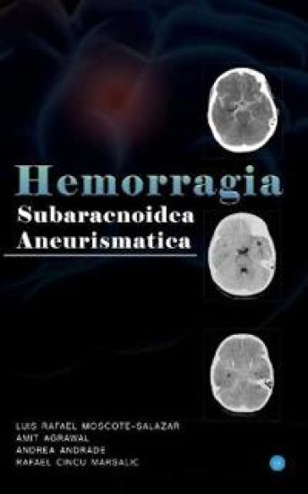 Hemorragia Subaracnoidea Aneurismatica – Amit Agrawal, kirjan kansikuva