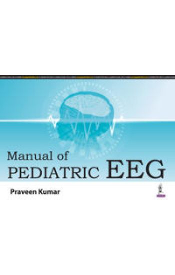 Manual of Pediatric EEG